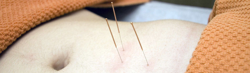 Accupuncture, Eastern Healing Arts in the Levittown, Bucks County PA area